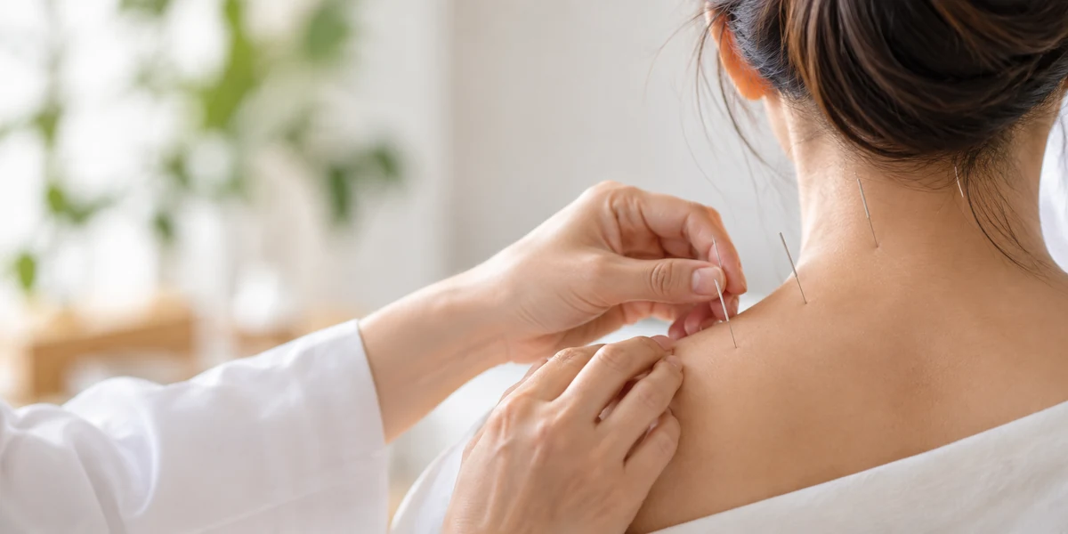 Acupuncture treatment at the neck and shoulder, showing needles and practitioner hands